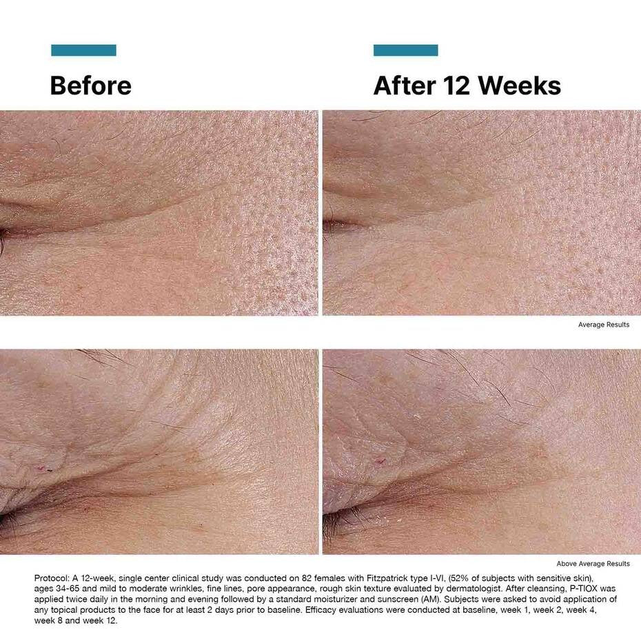 SkinCeuticals P-TIOX peptide anti-wrinkle serum, image 4 of 8